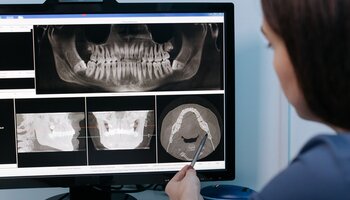 woman reviews images of dental X-rays on a computer screen